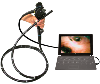 Endoscope/Gastroscope