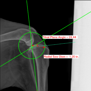 TPLO radiograph with Intellect Measurements