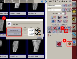 Metron Video Helper