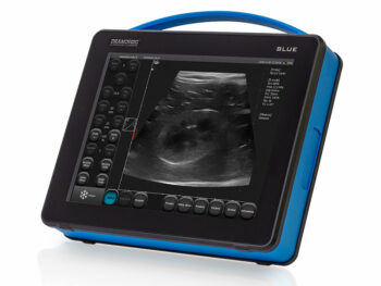 Blue Premium Portable Ultrasound